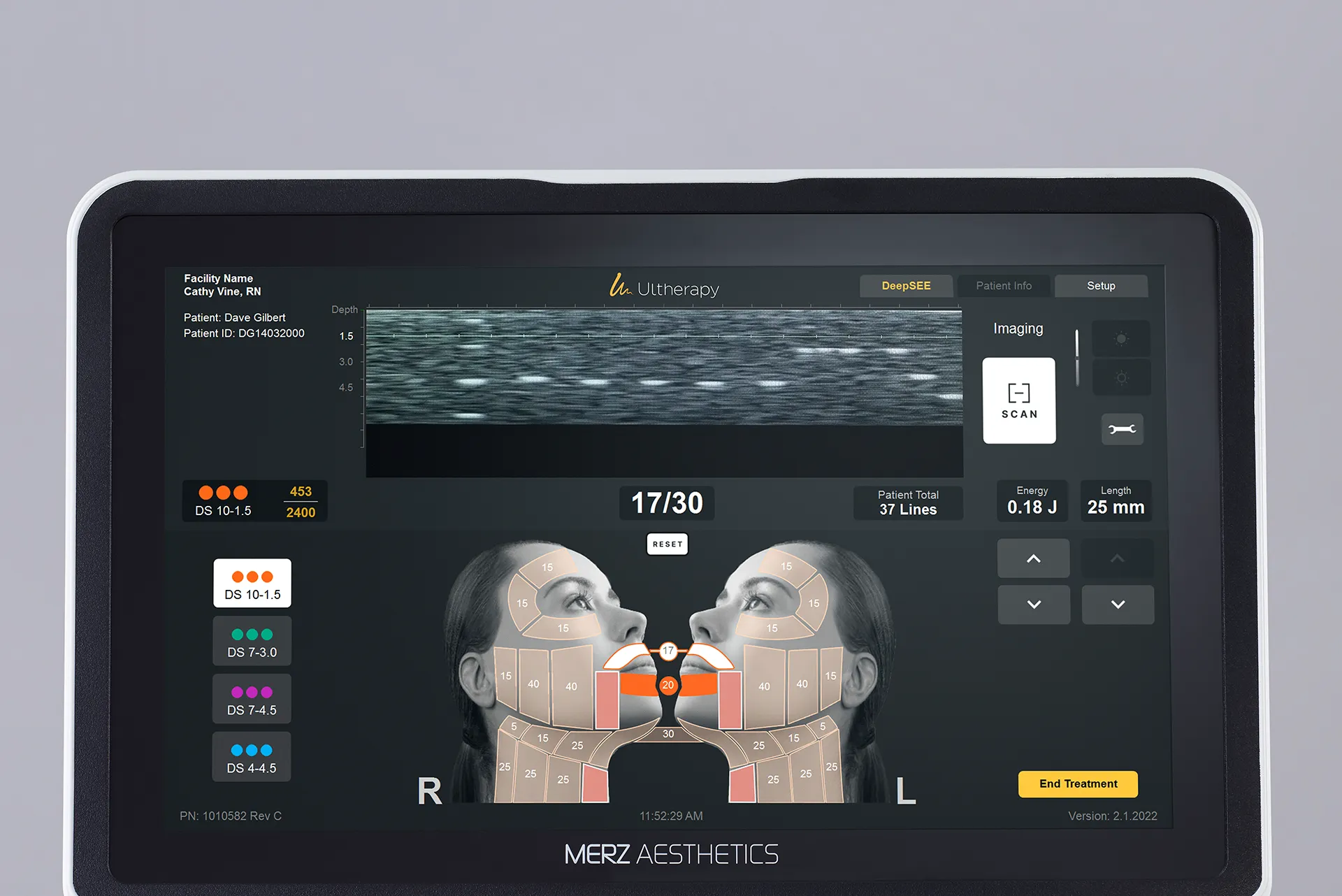 Monitor de Ultherapy PRIME® con tecnología de imágenes nítidas para tratamientos precisos, personalizados y consistentes.