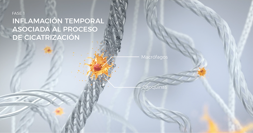 Visualización de los macrófagos durante la Fase 1 de cicatrización, que muestra inflamación temporal y reparación de tejido.